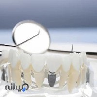 دندانسازی شادکام