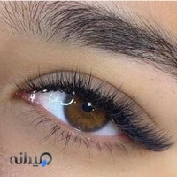 کاشت مژه الناز