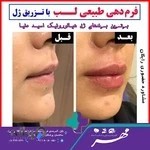 کلینیک زیبایی و لیزر مهر بابل دکتر الهام نصرالهی