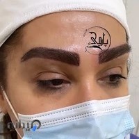 کاشت ابرو کرج طالقانی پارمیدا