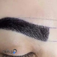 کلینیک کاشت ابرو و مو خزائی