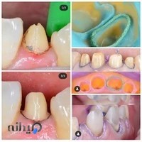 دندانپزشکی گلبرگ شرقی