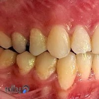 دندانپزشکی متخصصین نارمک_narmak_dentalexperts