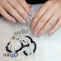 کاشت و ترمیم ناخن ستارخان تهران آرلا