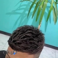 کلینیک پروتز مو ژست