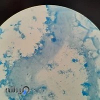 درمانگاه سل