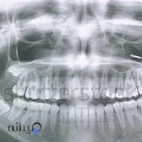 رادیولوژی، OPG و سونوگرافی پردیس
