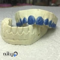 لابراتوار دندان سازی ویتا سنترال