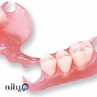 دندانپزشکی و دندانسازی شیوندی