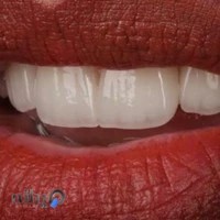 خلیلیان ( دندانسازی )