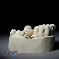 لابراتوار پروتزهای دندانی پرستیژ