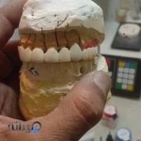 لابراتوار دندانسازی و پی اف ام