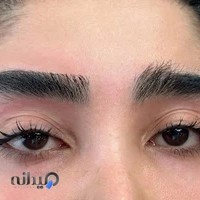 اصلاح تخصصي ابرو اصفهان راضیه رجبی