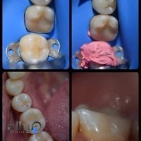 دکتر مسیح مجلسی-دندانپزشک ایمپلنت و زیبایی