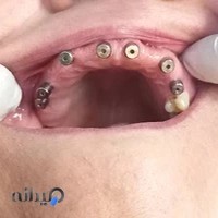 دندانپزشکی تابش