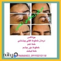 مرکز لیزر الماس