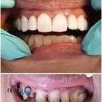 دندانپزشکی دکترشیماعسکر زاده