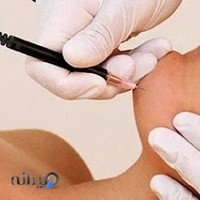 کلینیک لیزر آلا