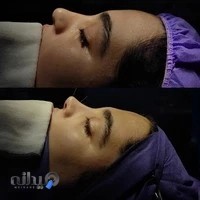 دکتر حسین اسماعیل طلایی(جراح بینی)