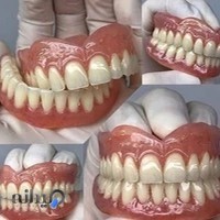 لابراتوار دندانسازی تضمینی ساخت دندان مصنوعی ژله ای و نرم