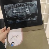 رادیولوژی فک و صورت راد پرتو Radparto Dental Radiology