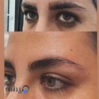 مرکز لیزر تاتو و پاکسازی پوست هانیه بهشتی