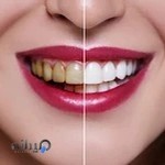 دکتر سعید رحمنی، دندانپزشک. متخصص ترمیمی. Dr.Saeed Rahmani. D.D.S