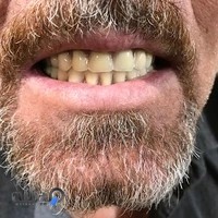 دندانسازی قائم