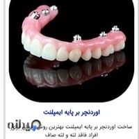لابراتوار دندانسازی علیزاده