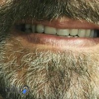 دندان سازی زنگنه