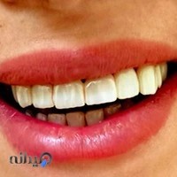 دکتر علی پور