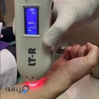 کلینیک زخم و سوختگی تهران پلاس