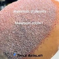 تکنسین و متخصص کاشت مو لبخند