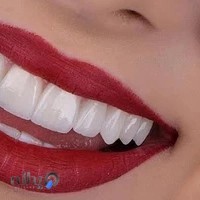 دندانپزشکی مقدم