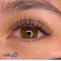 کاشت مژه نازبیوتی