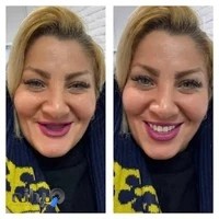 مرکز دندان مصنوعی زعفرانیه - نگین دندان