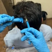 مرکز لیزر لوتوس