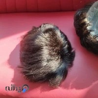 پروتز موی مجیدی