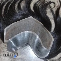 پروتز مو زرینی