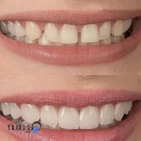 مطب دندانپزشکی دکتر فرزاد کهنه پوشی