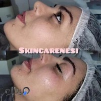 خدمات پوستی خانوم نسا جهان و جوان‌سازی و یون تراپی بدن(سم زادی بدن)