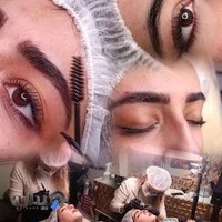 میکروبلیدینگ یسنا جودی