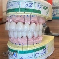 لابراتوار دندانسازی سیب