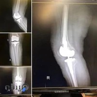 دکتر شهداد منصوری جراح ارتوپدی