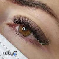 کاشت مژه فهیمه