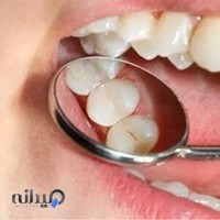 دندانسازی پژوهان