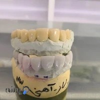 لابراتوار پروتزهای دندانی اینجی