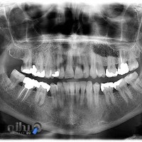 موسسه تخصصی رادیولوژی دهان ، فک و صورت دکتر مرجان بابادی بروجنی