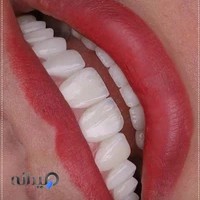 دندانپزشکی دکتر چاوش