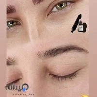 میکروبلیدینگ و میکروپیگمنتیشن چشم، لب و ابرو